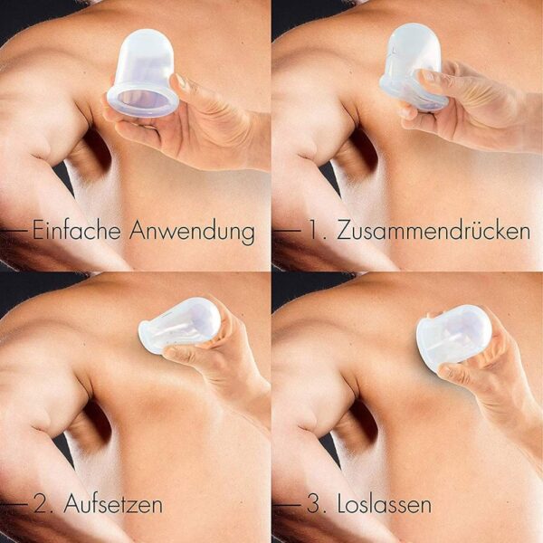Koppning för behandling & massage av ansikte 4-pack Olika storlekar Transparent
